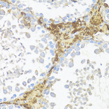 AMH Polyclonal Antibody (E-AB-67996)