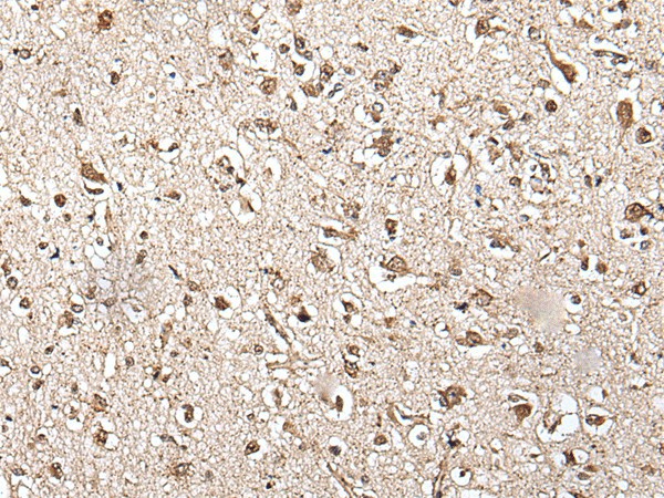 ZFP36 Polyclonal Antibody (E-AB-52369)