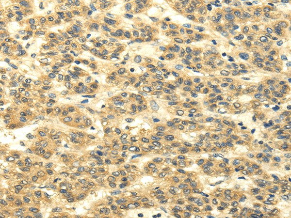 MSI1 Polyclonal Antibody (E-AB-17518)
