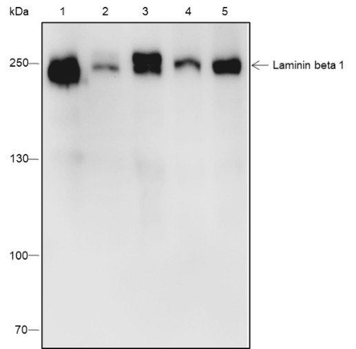 Recombinant Laminin beta 1 Monoclonal Antibody (AN301833L)