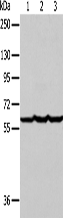 Factor IX Polyclonal Antibody (E-AB-14396)