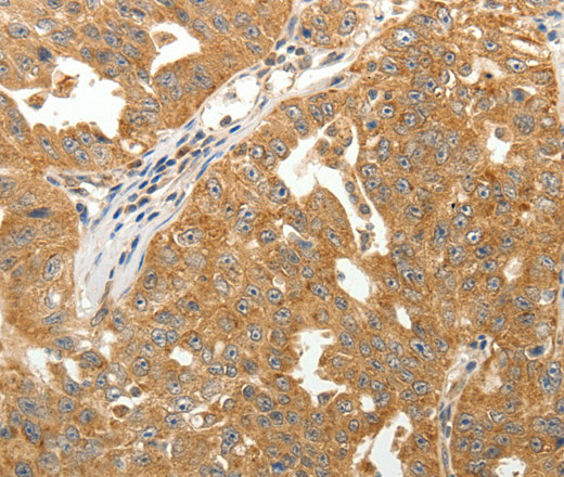 MAP1B Polyclonal Antibody (E-AB-16086)
