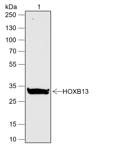 Recombinant HOXB13 Monoclonal Antibody (AN301916L)