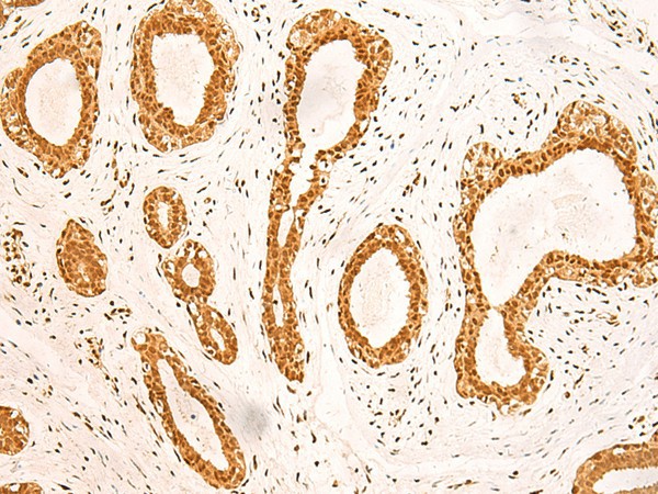 ZNF471 Polyclonal Antibody (E-AB-52793)