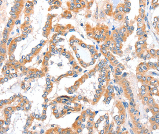 ACSBG1 Polyclonal Antibody (E-AB-14482)
