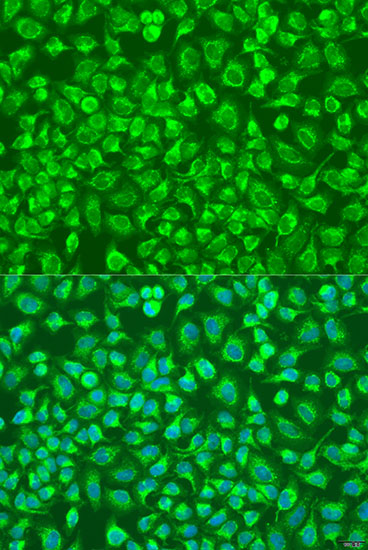 ENTPD5 Polyclonal Antibody (E-AB-67947)