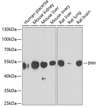 IHH Polyclonal Antibody (E-AB-61257)