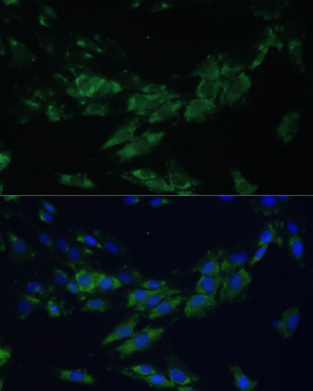 EPHA4 Polyclonal Antibody (E-AB-62730)
