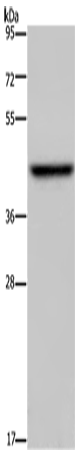 ENTPD5 Polyclonal Antibody (E-AB-14989)