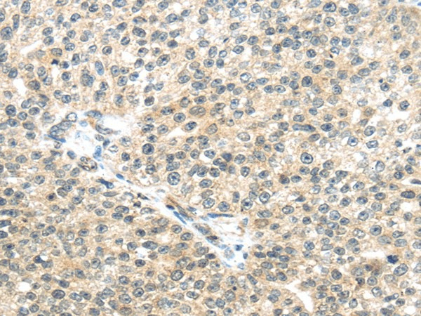 TTBK2 Polyclonal Antibody (E-AB-17479)