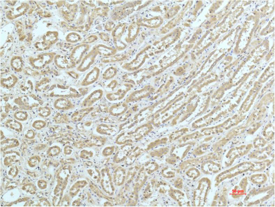 ACTN1 Monoclonal Antibody (E-AB-22127)