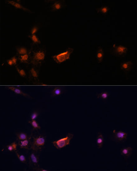 BRCA2 Polyclonal Antibody (E-AB-67462)