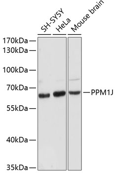 PPM1J Polyclonal Antibody (E-AB-64347)