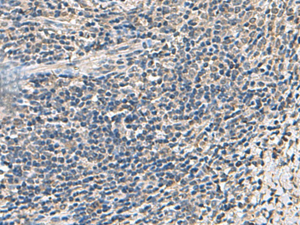 ATP5F1D Polyclonal Antibody (E-AB-19138)