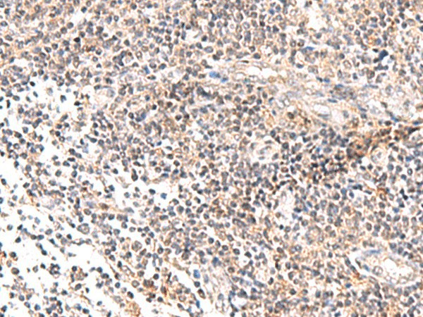IL36B Polyclonal Antibody (E-AB-52017)