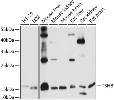 TSHB Polyclonal Antibody (E-AB-90872)