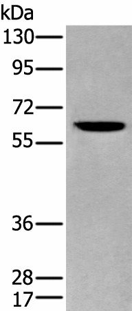 ZKSCAN1 Polyclonal Antibody (E-AB-52371)