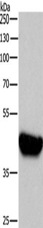 BABAM2 Polyclonal Antibody (E-AB-11008)