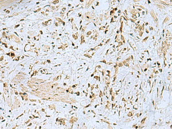 HOXC9 Polyclonal Antibody (E-AB-19469)