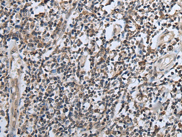 CXCL6 Polyclonal Antibody (E-AB-53483)