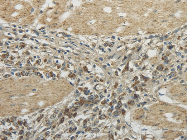 TRIB2 Polyclonal Antibody (E-AB-17147)