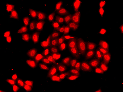 CAMK1D Polyclonal Antibody (E-AB-61759)