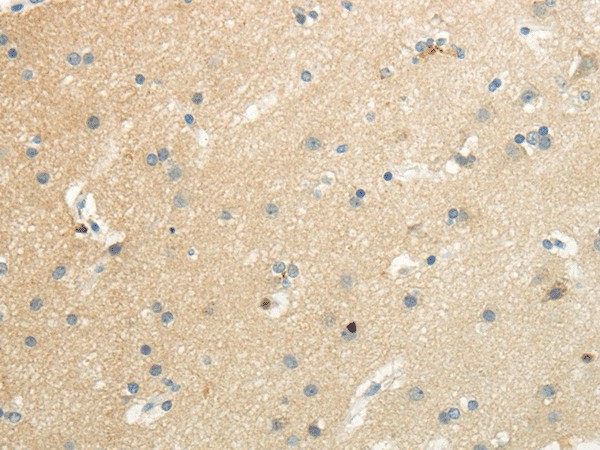 SLC7A11 Polyclonal Antibody (E-AB-17625)