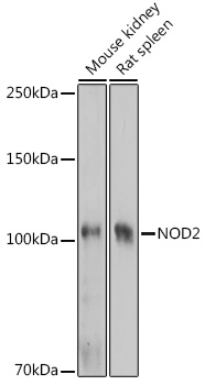 NOD2 Polyclonal Antibody (E-AB-91396)