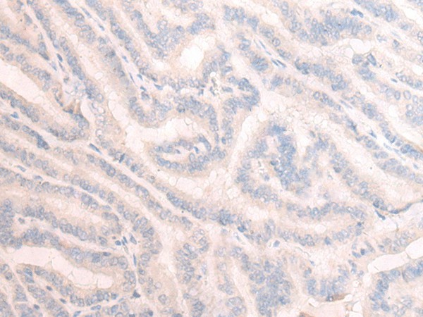 TBC1D2 Polyclonal Antibody (E-AB-52646)