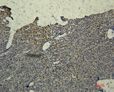 Transferrin Monoclonal Antibody (E-AB-22197)