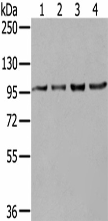 NUP98 Polyclonal Antibody (E-AB-17530)