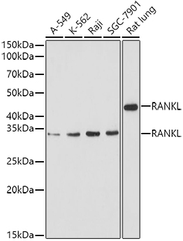 RANKL Polyclonal Antibody (E-AB-68352)