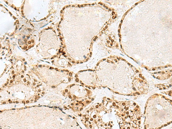 GTF3C2 Polyclonal Antibody (E-AB-52763)