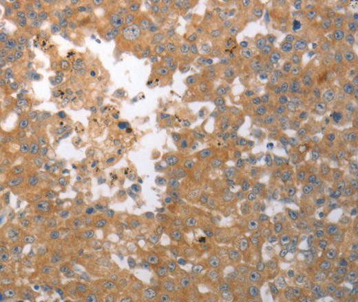 SHH Polyclonal Antibody (E-AB-15842)