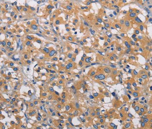 PIKFYVE Polyclonal Antibody (E-AB-14682)