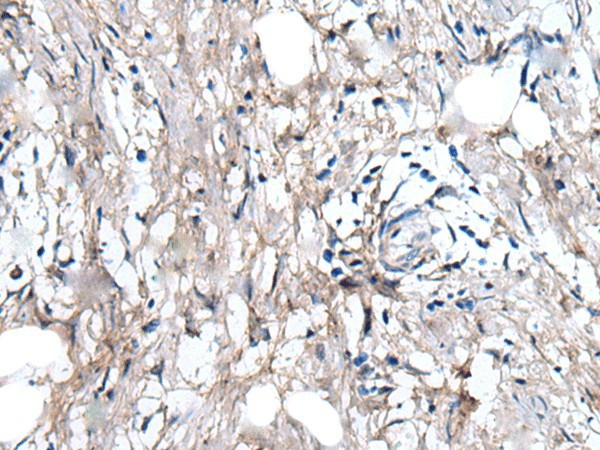 WRN Polyclonal Antibody (E-AB-53558)