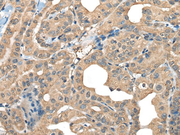 CABP5 Polyclonal Antibody (E-AB-18578)