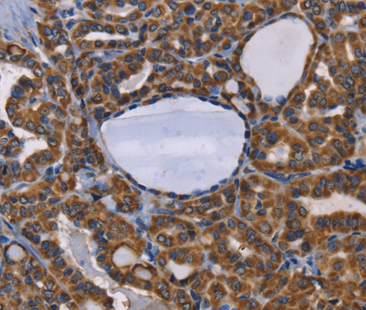 GRK3 Polyclonal Antibody (E-AB-10892)