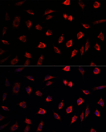 NEDD1 Polyclonal Antibody (E-AB-62567)