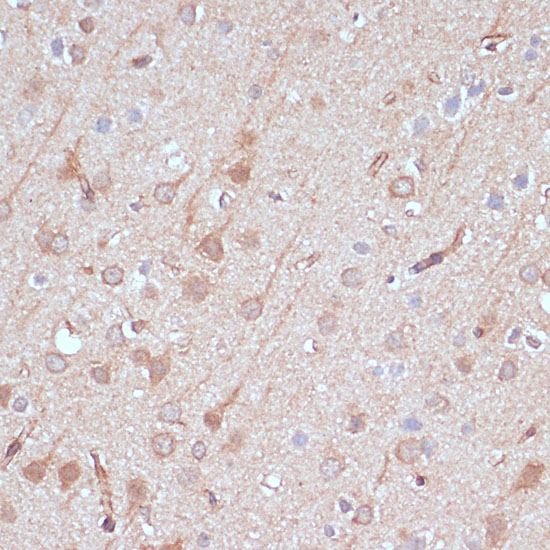 AK5 Polyclonal Antibody (E-AB-65310)