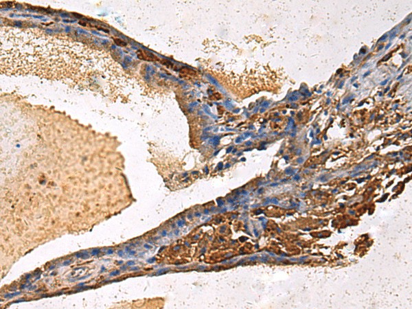 LYAR Polyclonal Antibody (E-AB-53180)