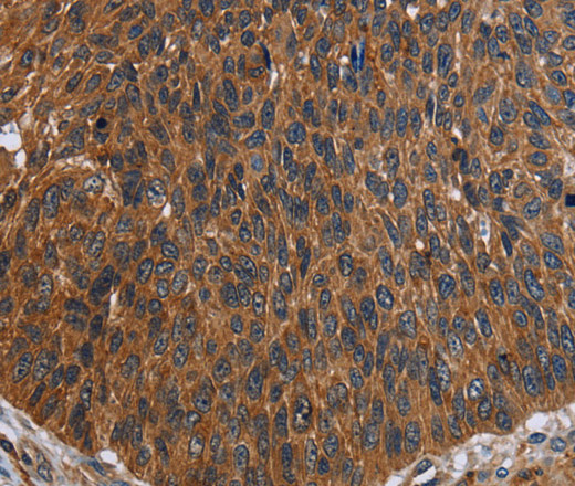 FCGR3A Polyclonal Antibody (E-AB-15125)