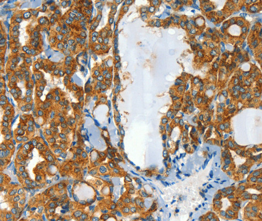 CLPTM1L Polyclonal Antibody (E-AB-13157)