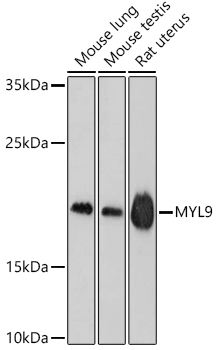 MYL9 Polyclonal Antibody (E-AB-67536)