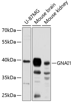 GNAI1 Polyclonal Antibody (E-AB-92918)