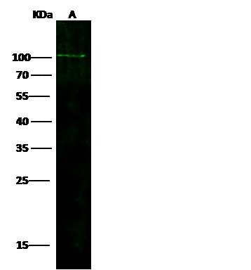 Recombinant ADAM12 Monoclonal Antibody (AN300106P)