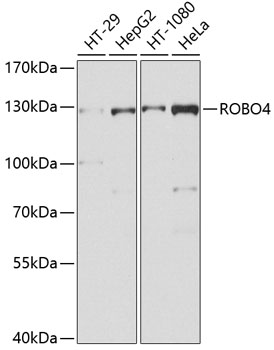 ROBO4 Polyclonal Antibody (E-AB-62460)