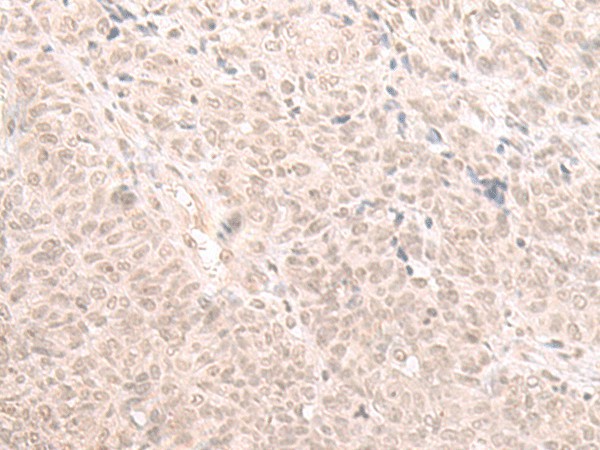 HOOK2 Polyclonal Antibody (E-AB-52664)