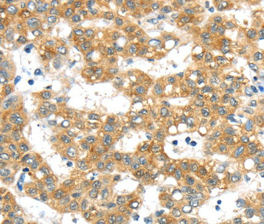 PTPN4 Polyclonal Antibody (E-AB-16740)