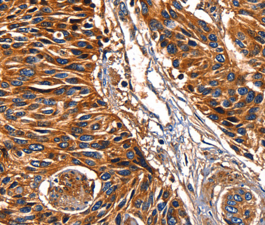 Galectin 8 Polyclonal Antibody (E-AB-14094)